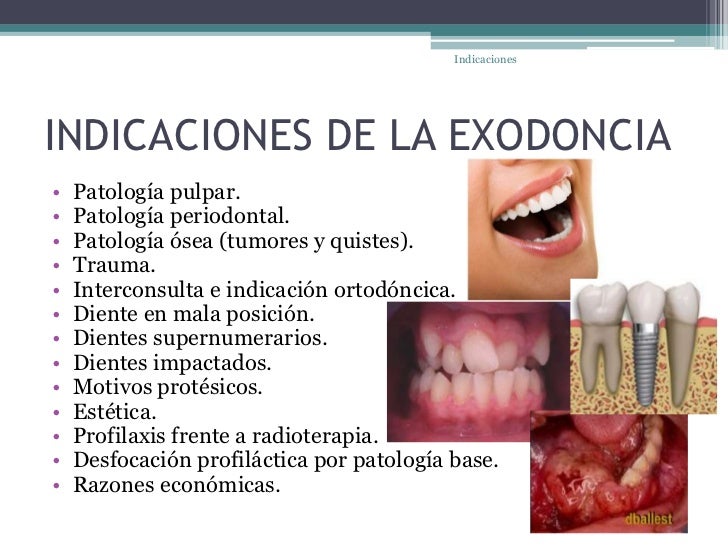 ” El personal de Asistente Dental, debe considerarse como figura