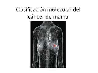 Clasificación molecular del
cáncer de mama
 
