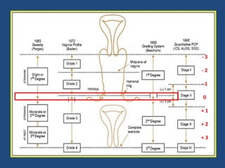 -3
-2
-1
0

+1
+2
+3

 