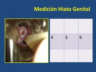 Medición Hiato Genital

9cm

4

3

9

 
