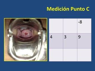 Medición Punto C
-8
8cm

4

3

9

 