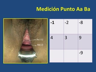 Medición Punto Aa Ba
-1

Aa (-1)

-2

-8

4

3

9

Ba(-2)

-9

 