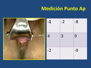 Medición Punto Ap
-1
Ap(-2)

-2

-8

4

3

9

-2

-9

 