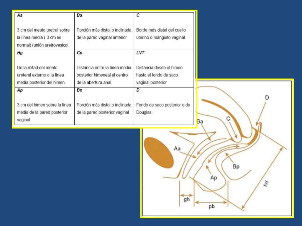 Clasificación pop q