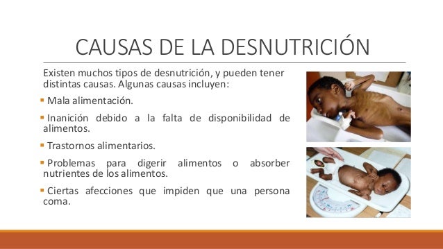Clasificacion de desnutricion