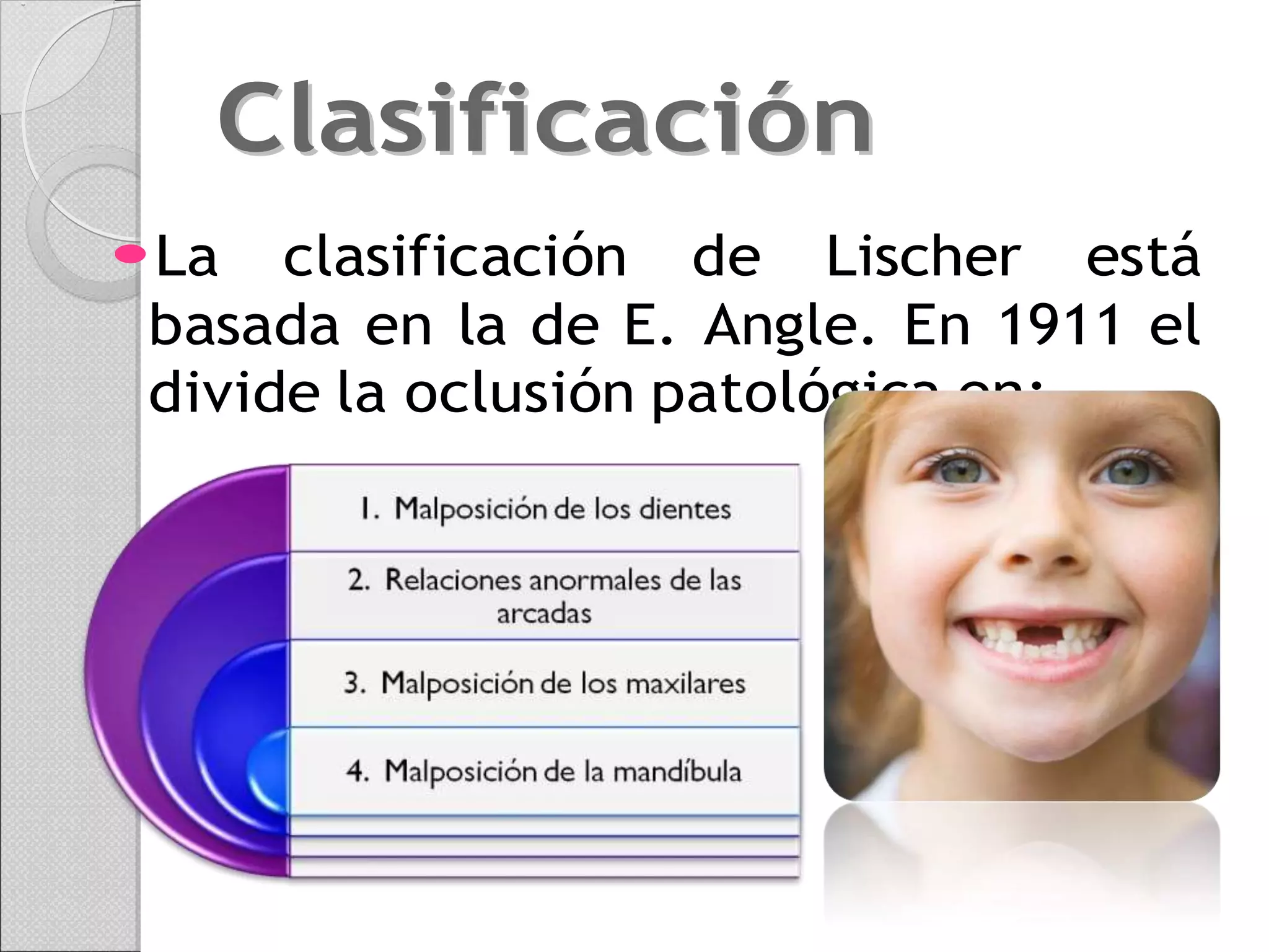 clasificacion-de-lisher.docx
