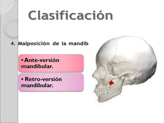 clasificacion-de-lisher.docx