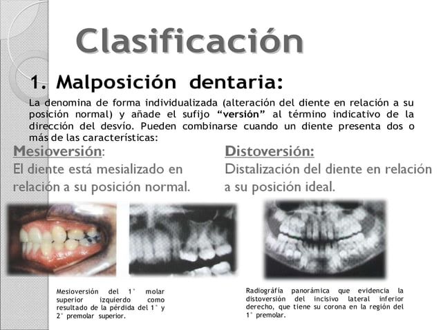 clasificacion-de-lisher.docx