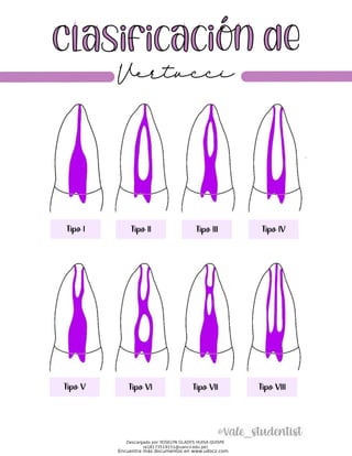 Vertuc Classification clasificacion-de-vertucci.pdf