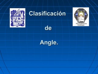 Clasificación

     de

   Angle.
 