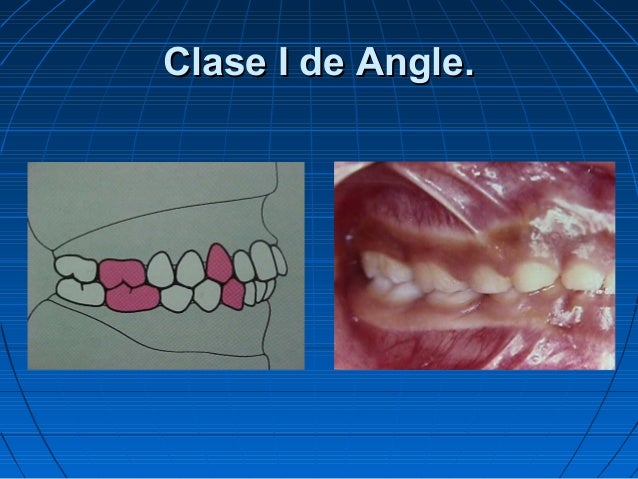 Free fact triangles worksheets Clasificacion angle