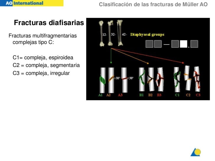 Clasificacion Ao Clasificacion Ao