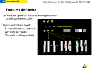 Clasificación de las fracturas de Müller AO
Las fracturas tipo B son fracturas multifragmentarias
con un fragmento en cuña
Grupos de fracturas tipo B:
B1 = espiroidea con una cuña,
B2 = cuña por flexión
B3 = cuña multifragmentada
12- 32-32- 42-42-
C1 C2 C3A1 A2 A3
>30°>30° <30°<30°
Diaphyseal groups
— .
B1 B2 B3
Fracturas diafisarias
 