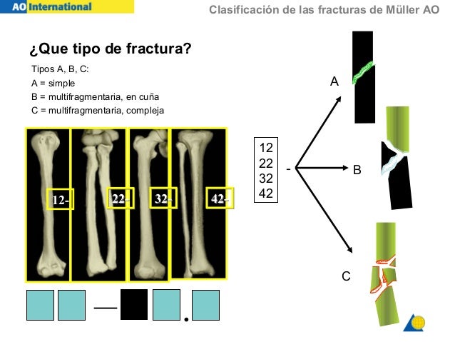01 Clasificacion Ao 01 Clasificacion Ao
