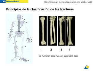 Clasificación de las fracturas de Müller AO
Principios de la clasificación de las fracturas
Se numeran cada hueso y segmento óseo
1 2 3 4
 