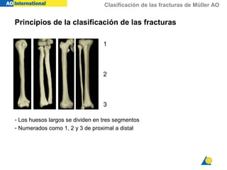 Clasificación de las fracturas de Müller AO
- Los huesos largos se dividen en tres segmentos
- Numerados como 1, 2 y 3 de proximal a distal
1
2
3
Principios de la clasificación de las fracturas
 