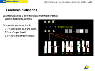 Clasificación de las fracturas de Müller AO
Las fracturas tipo B son fracturas multifragmentarias
con un fragmento en cuña
Grupos de fracturas tipo B:
B1 = espiroidea con una cuña,
B2 = cuña por flexión
B3 = cuña multifragmentada
12- 32-32- 42-42-
C1 C2 C3A1 A2 A3
>30°>30° <30°<30°
Diaphyseal groups
— .
B1 B2 B3
Fracturas diafisarias
 