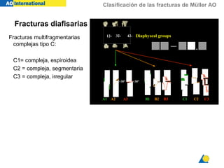 Clasificación de las fracturas de Müller AO
Fracturas multifragmentarias
complejas tipo C:
C1= compleja, espiroidea
C2 = compleja, segmentaria
C3 = compleja, irregular
12- 32-32- 42-42-
C1 C2 C3A1 A2 A3
>30°>30° <30°<30°
Diaphyseal groups
— .
B1 B2 B3
Fracturas diafisarias
 