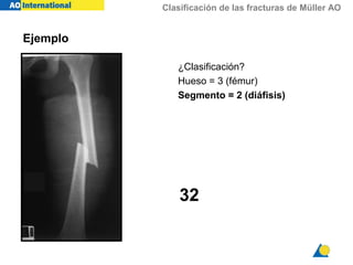 Clasificación de las fracturas de Müller AO
32
Ejemplo
¿Clasificación?
Hueso = 3 (fémur)
Segmento = 2 (diáfisis)
 