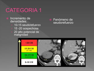  Incremento de
densidades.
› 10-15 seudorefuerzo
› 15 -20 sospechosa
› 20 alto potencial de
malignidad
 Fenómeno de
seudorefuerzo
 