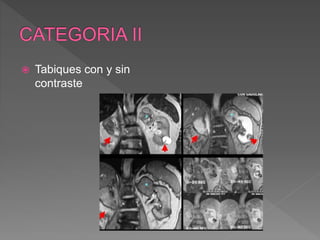  Tabiques con y sin
contraste
 