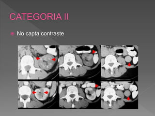 No capta contraste
 
