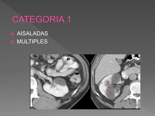  AISALADAS
 MULTIPLES
 