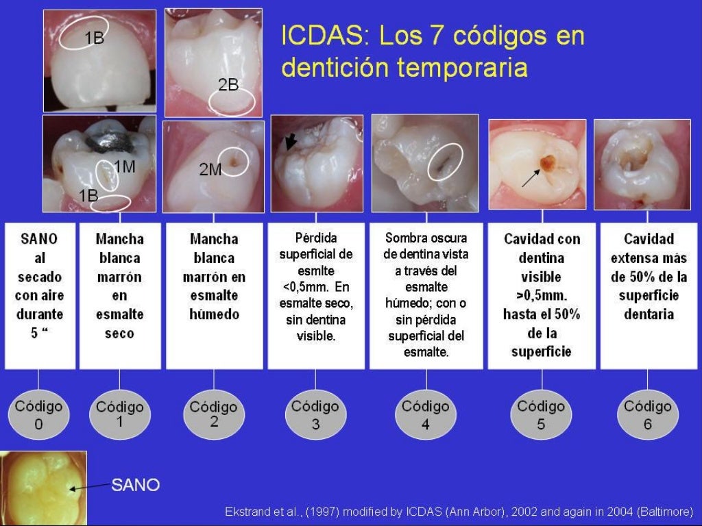 Clasificacion caries dental