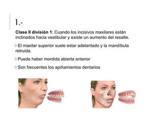 1.-
Clase II división 1: Cuando los incisivos maxilares están
inclinados hacia vestibular y existe un aumento del resalte.
El maxilar superior suele estar adelantado y la mandíbula
retruida.
Puede haber mordida abierta anterior
Son frecuentes los apiñamientos dentarios
 