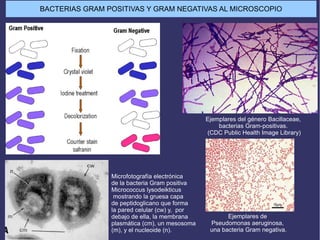 Ejemplares del género Bacillaceae,
bacterias Gram-positivas.
(CDC Public Health Image Library)
Ejemplares de
Pseudomonas aeruginosa,
una bacteria Gram negativa.
Microfotografía electrónica
de la bacteria Gram positiva
Micrococcus lysodeikticus
mostrando la gruesa capa
de peptidoglicano que forma
la pared celular (cw) y, por
debajo de ella, la membrana
plasmática (cm), un mesosoma
(m), y el nucleoide (n).
BACTERIAS GRAM POSITIVAS Y GRAM NEGATIVAS AL MICROSCOPIO
 