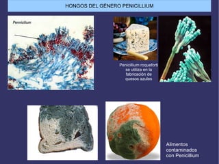 Alimentos
contaminados
con Penicillium
Penicillium roqueforti
se utiliza en la
fabricación de
quesos azules
HONGOS DEL GÉNERO PENICILLIUM
 