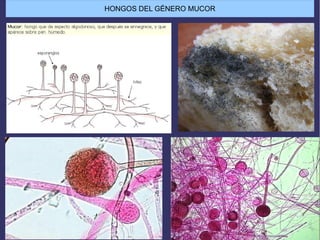 HONGOS DEL GÉNERO MUCOR
 