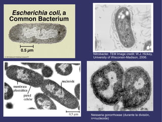 Neisseria gonorrhoeae (durante la división,
n=nucleoide)
Nitrobacter. TEM Image credit: W.J. Hickey,
University of Wisconsin-Madison, 2006.
 