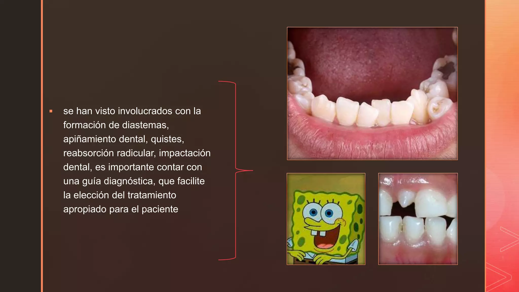 Clasificacion de dientes supernumerarios | PPTX