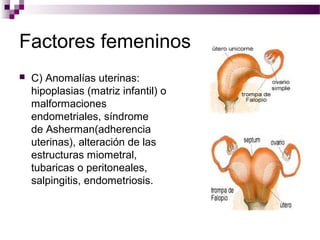 Factores femeninos
 C) Anomalías uterinas:
hipoplasias (matriz infantil) o
malformaciones
endometriales, síndrome
de Asherman(adherencia
uterinas), alteración de las
estructuras miometral,
tubaricas o peritoneales,
salpingitis, endometriosis.
 