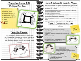 Elementos de una PPR
Es la unidad de la prótesis parcial que conecta las
partes localizadas en un lado del arco con aquellas del
lado opuesto. En esta unidad de prótesis están unidas
directa o indirectamente todas las otras partes (parte
esencial).
Conector Mayor:
Características del Conector Mayor
Tipos de Conectores Mayores
Inferiores
1) Debe ser construido en una aleación compatible con los tejidos bucales.
2) Debe ser rígido para una amplia y correcta distribución de las fuerzas.
3) No interferir con la lengua.
4) No debe alterar sustancialmente el contorno natural de la superficie
lingual, alveolar o bóveda palatina.
5) No comprimir los tejidos bucales.
6) No cubrir más tejido que el absolutamente necesario.
7) No contribuir con la retención de alimento.
8) Debe estar localizado en inferior a 4 mm del margen gingival (tipo
barra).
9) Debe estar localizado en superior a 6 mm del margen gingival.
-Se coloca 4 mm por debajo de la encía adherida
-Borde inferior ubicarse de forma que no invada los tejidos
de piso de boca
-Colocarse tan abajo como sea posible para no interferir con
la lengua
-Que no atrape comida
-5mm de altura
CONTRAINDICACIONES: -Presencia de torus lingual.
-Caso de inserción alta del frenillo lingual
INDICACIONES
-Dientes posteriores faltantes
-Dientes pilares débiles periodontalmente
-Frenillo lingual de inserción alta
-Piso de boca alto
-Torus lingual inoperable
-Paciente que no tolera la barra lingual
-Tendencia a cálculo dental
-Previene extrusión
Dr. Vargas Perez Xavier
 