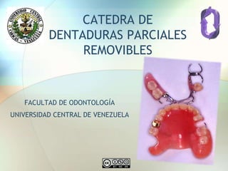 CATEDRA DE
DENTADURAS PARCIALES
REMOVIBLES
FACULTAD DE ODONTOLOGÍA
UNIVERSIDAD CENTRAL DE VENEZUELA
 