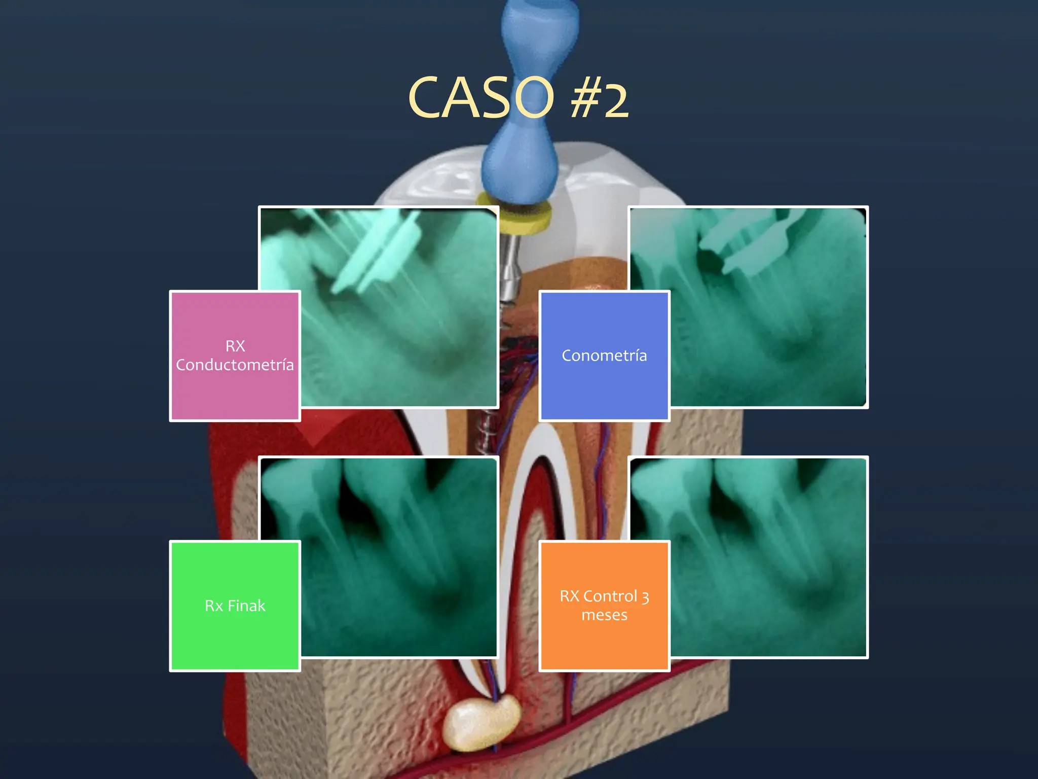 Clasificación de la patología pulpar y periapical según la AAE (1).pdf