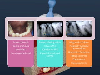 Clasificación de la patología pulpar y periapical según la AAE (1).pdf