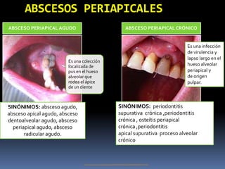 clasificacion-de-las-bolsas-periodontales-y-sondeo-periodontal-2-pptx