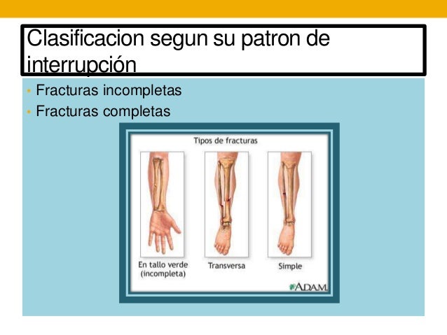 T tulos relacionados
