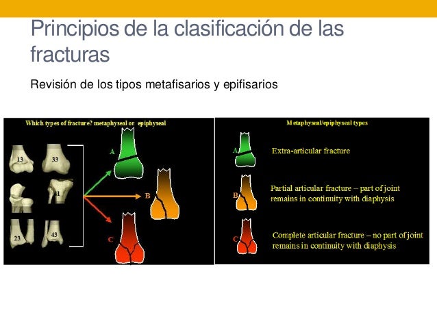 Temas de AO Education en Espa ol