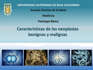 UNIVERSIDAD AUTÓNOMA DE BAJA CALIFORNIA
        Escuela Ciencias de la Salud
                 Medicina
             Patología Básica

Características de las neoplasias
      benignas y malignas
 