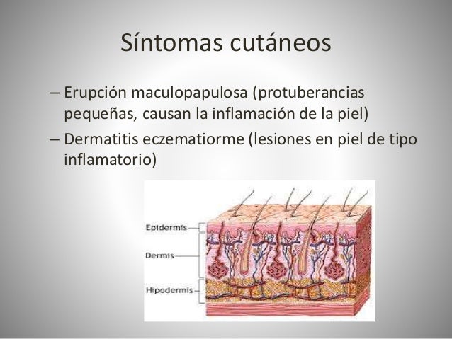 El aceite de melocotón para la psoriasis