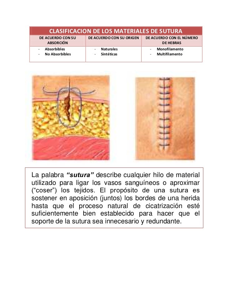 Clasificacion de los hilos de sutura