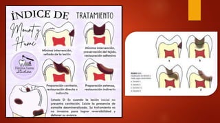 Mount Home Classification System CLASIFICACION DE MOUNT HUME -TRABAJO.pptx