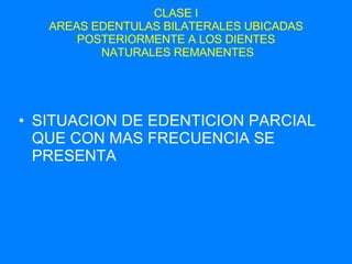 CLASE I AREAS EDENTULAS BILATERALES UBICADAS POSTERIORMENTE A LOS DIENTES  NATURALES REMANENTES SITUACION DE EDENTICION PARCIAL QUE CON MAS FRECUENCIA SE PRESENTA 