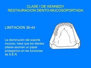 CLASE I DE KENNEDY RESTAURACION DENTO-MUCOSOPORTADA LIMITACION 36-44 La disminución del soporte mucoso, hace que los dientes pilares asuman un papel protagónico en las funciones de S.E.R. 