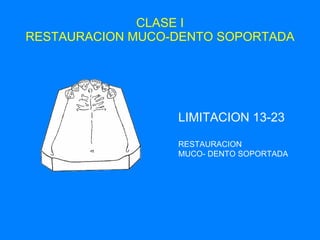 CLASE I RESTAURACION MUCO-DENTO SOPORTADA LIMITACION 13-23 RESTAURACION  MUCO- DENTO SOPORTADA 