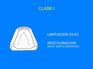 CLASE I LIMITACION 33-43 RESTAURACION   MUCO- DENTO SOPORTADA 
